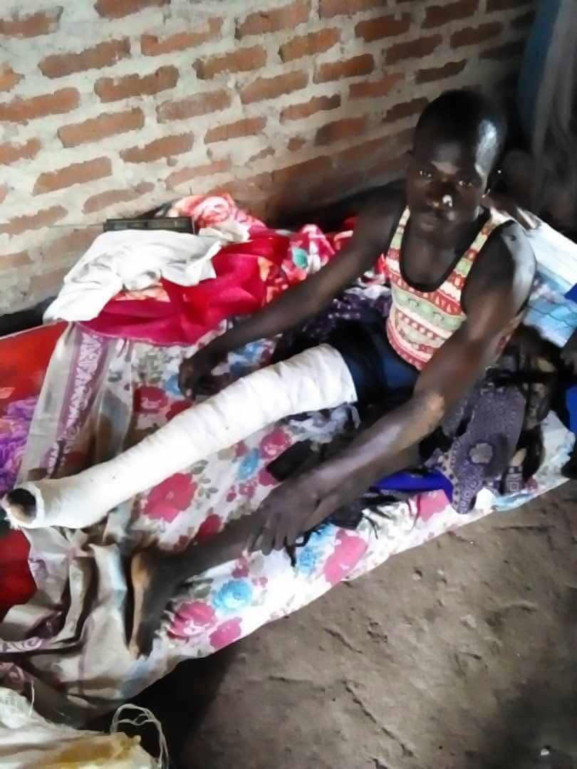 Pastor Mesach's recovery journey — before photograph